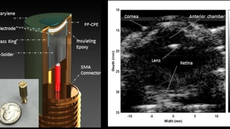 Illustration of 3D piezoelectric element for ultrasound transducer